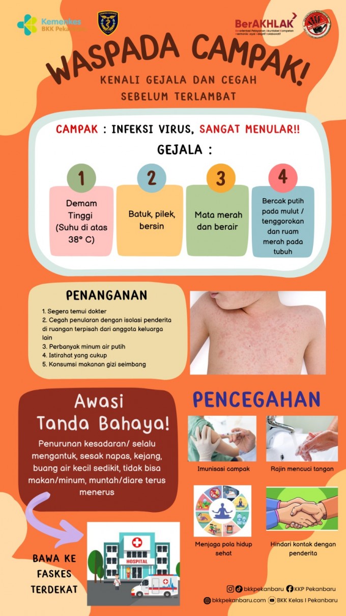 Campak bukan sekadar “ruam biasa”